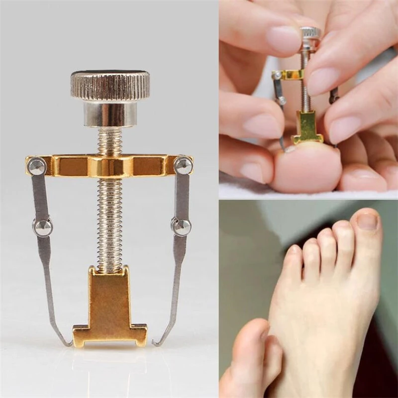 Ingrown Toenail Corrector Pedicure Toenail Fixer Foot Nail Care Orthotic Stainless Steel Treatment Onyxis Bunion Correction Tool