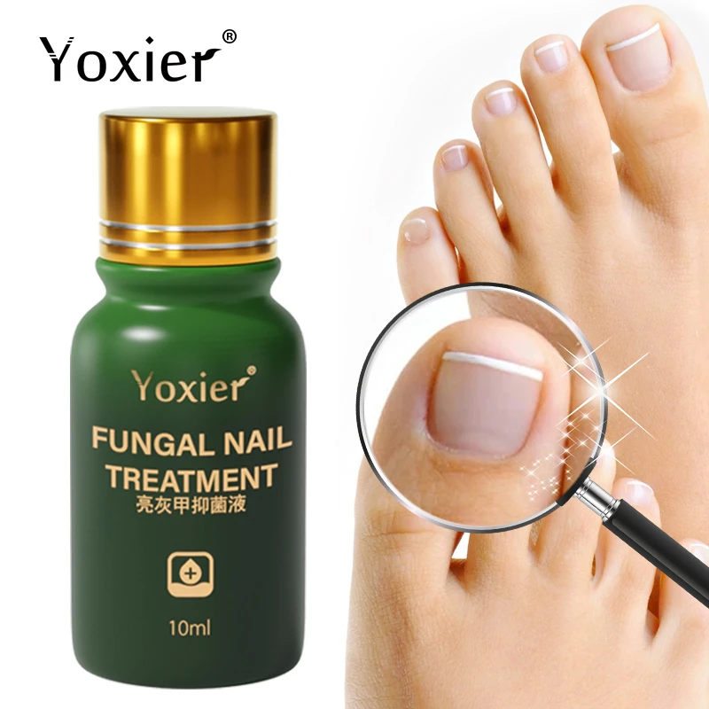 Yoxier Fungal Nail Treatment Antibacterial Serum Repair Rough Discolored Anti Infection Paronychia Onychomycosis Foot Care