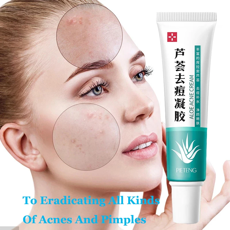 Effective Acne Removal Cream Acne Treatment Fade Acne Spots Oil Control Shrink Pores Whitening Moisturizing Acne Cream Skin Care