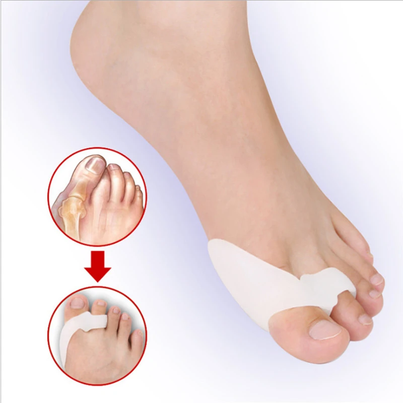 2PCS Silicone Gel Thumb Corrector Bunion Little Toe Protector Separator Hallux Valgus Finger Straightener Foot Care Relief Pads