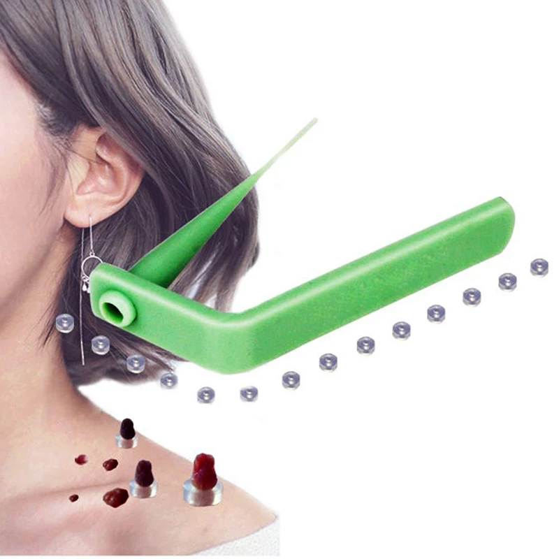 Medical Skin Tag Kill Skin Mole Wart Remover Micro Band Skin Tag Removal Kit With Cleansing Remove Warts Body Skin Care Tools