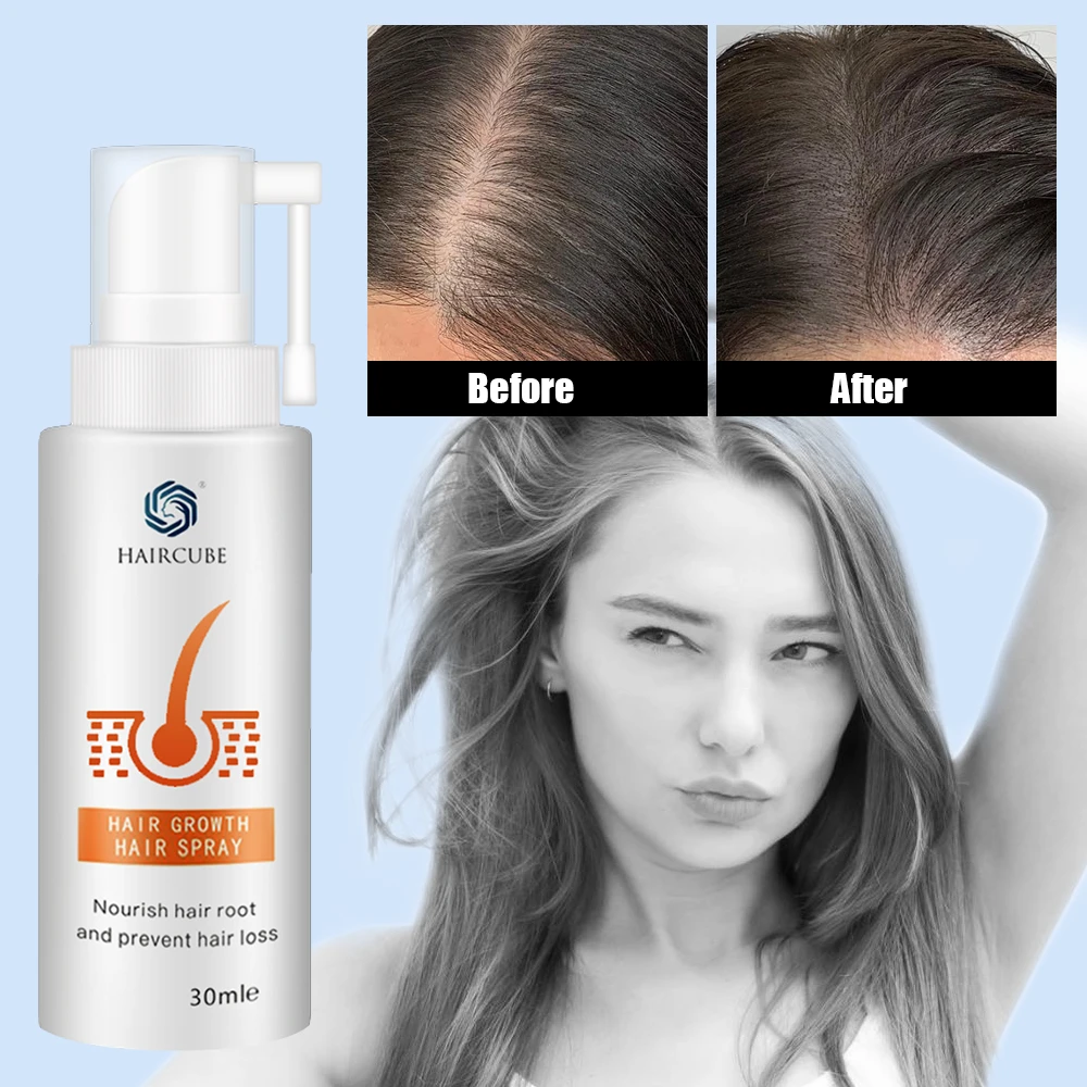 HAIRCUBE Stop Anti Hair Loss Fast Hair Growth Products For Men Woman Hair Growth Spray Essential Oil Liquid Essence Regeneration