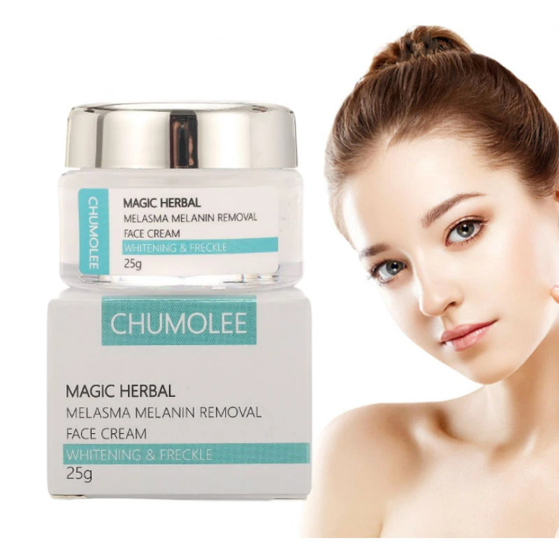 CHUMOLEE Whitening Face Cream Remove Freckle Melasma Acne Dark Pigment Spot Melanin Pimple Sunburn Brighten Face Skin Care