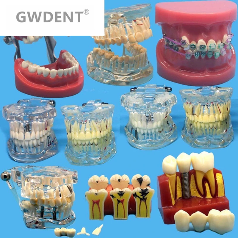 Various Dental Teeth Models Are Used For Teaching And Hospital Dentist Material