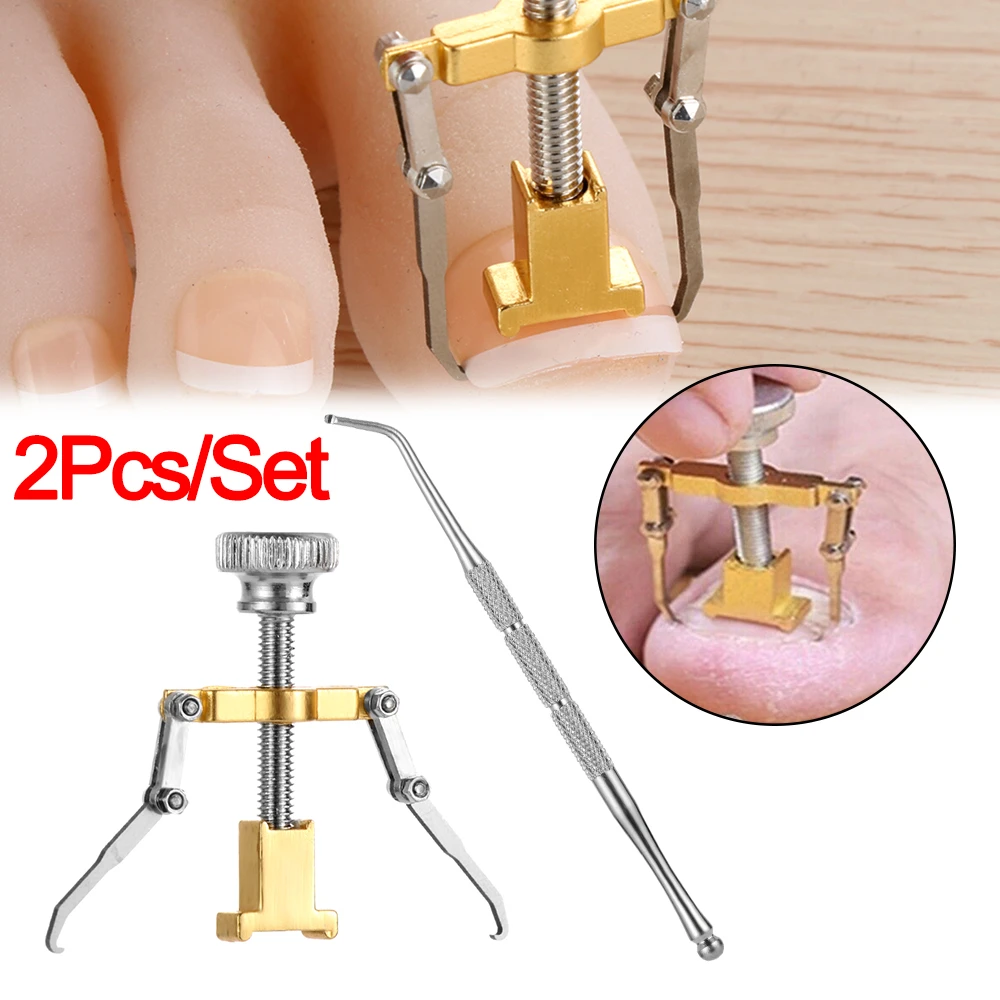 1Set Professional Effectiv Treatment Ingrown Toenail Correction Pedicure Tools Paronychia Foot Care Nail Recover Tools