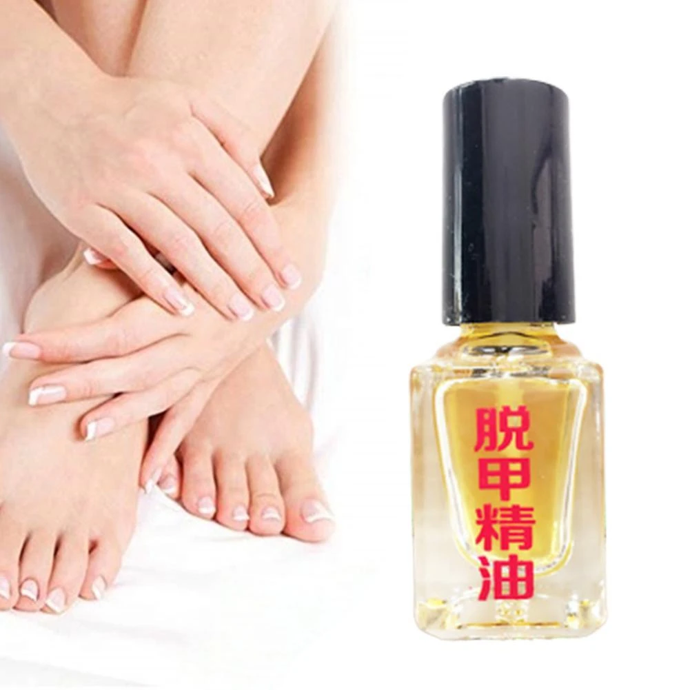 Nail Removal Essential Oil Onychomycosis Liquid Nail Liquid Fungus Removal Essence Liquid Fungal Nail Treatment Bright Nail Oil