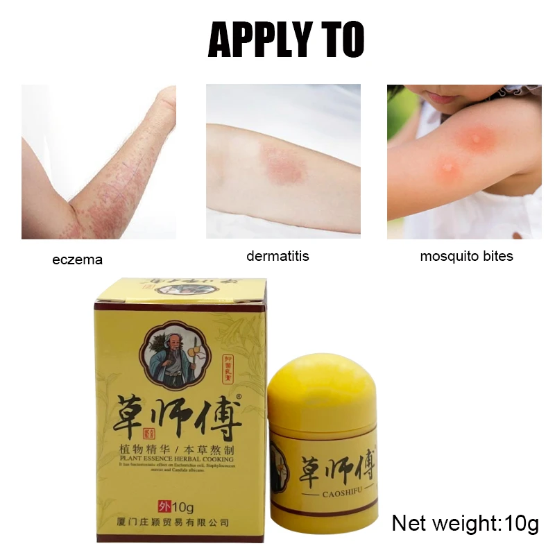 Psoriasis Dermatitis Eczematoid Eczema Ointment Anti-Itch Chinese Herb Medical Skin Care Cream