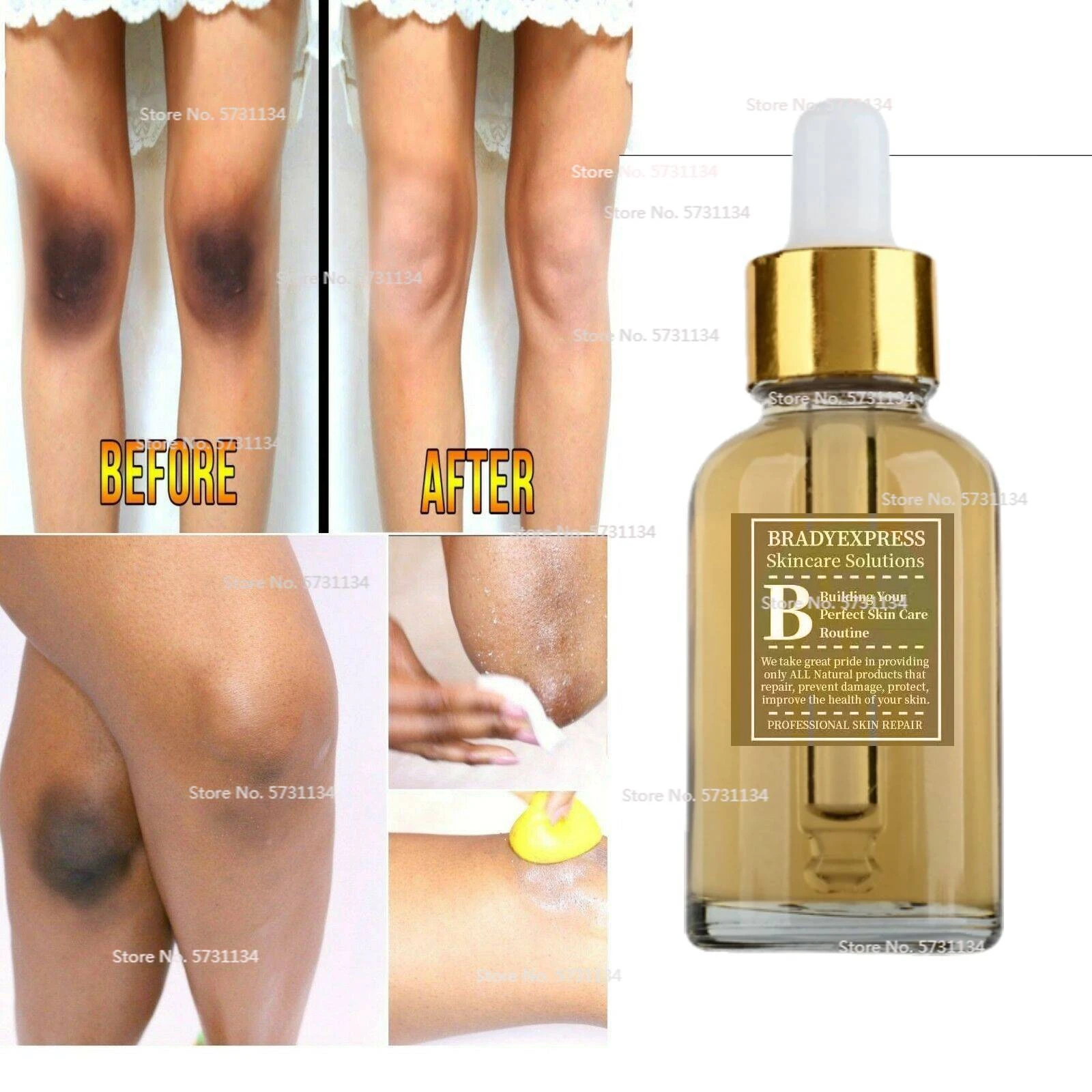 DARK KNEES AND ELBOWS LIGHTENING Serum, Dark Spots Cream Body Oil