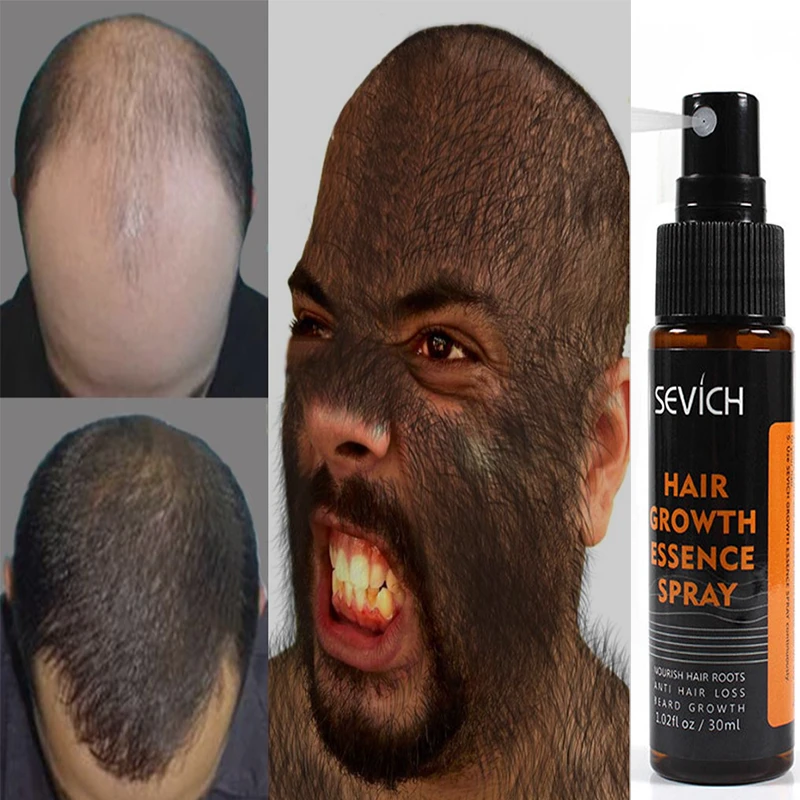 Sevich Hair Growth Essence Spray Hair loss Treatment Preventing Hair Loss spray hair Growth Essence Hair Care 30ml