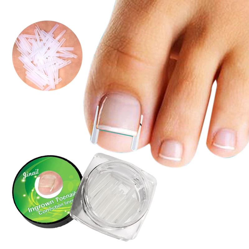 10pcs/set Ingrown Nail Pad Ortho Nail Filling Nail Groove Pad Ingrown Nail Corrector Ingrown Nail Artifact