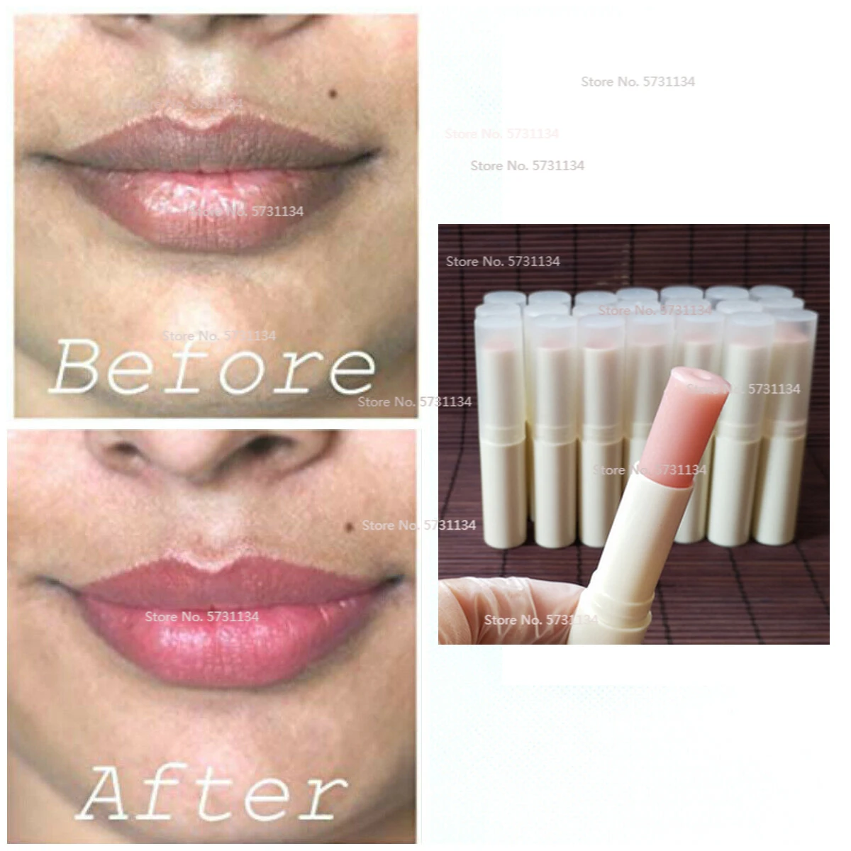Dark Lip Lightening Product ,Lip Bleaching, Whitening Lips to Pink Smokers too