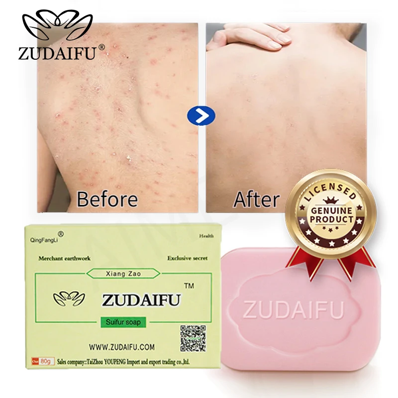 1/5/10PCS ZUDAIFU Sulfur soap natural Anti Fungus Perfume Butter Bubble Bath Healthy Soaps Skin