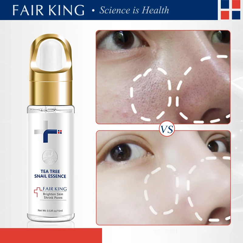 FAIR KING Snail Serum Facial Essence Hyaluronic Acido Hialuronico Whitening  For Face Skin Care Face Shrink Pores Anti Aging