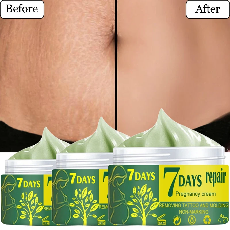 Removal Pregnancy Scars Cream Stretch Marks Treatment Maternity Body Repairing Moisturizing Firming Women Skin Care Cream