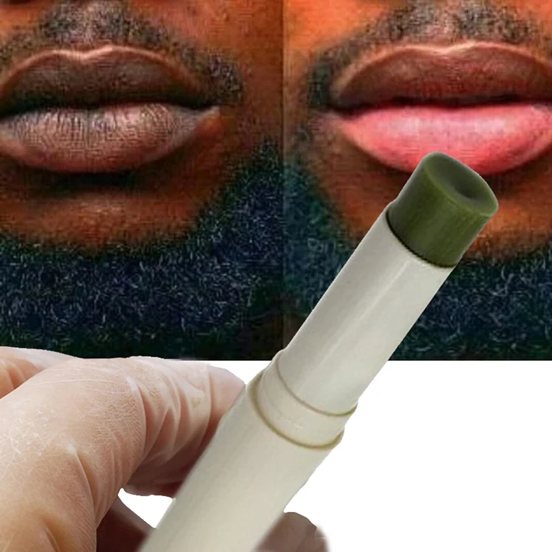 Lip care Of Lips Pink Fresh Lightening Bleaching Cream Treatment Remove Dark Smoke Lips lip oil
