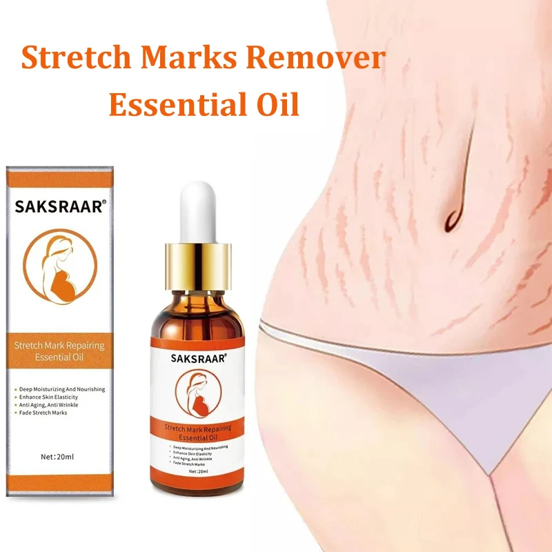 Stretch Marks Remover Essential Oil Skin Care Treatment Cream For Stretch Mark Removal Maternity Slackline For Pregnant Oils