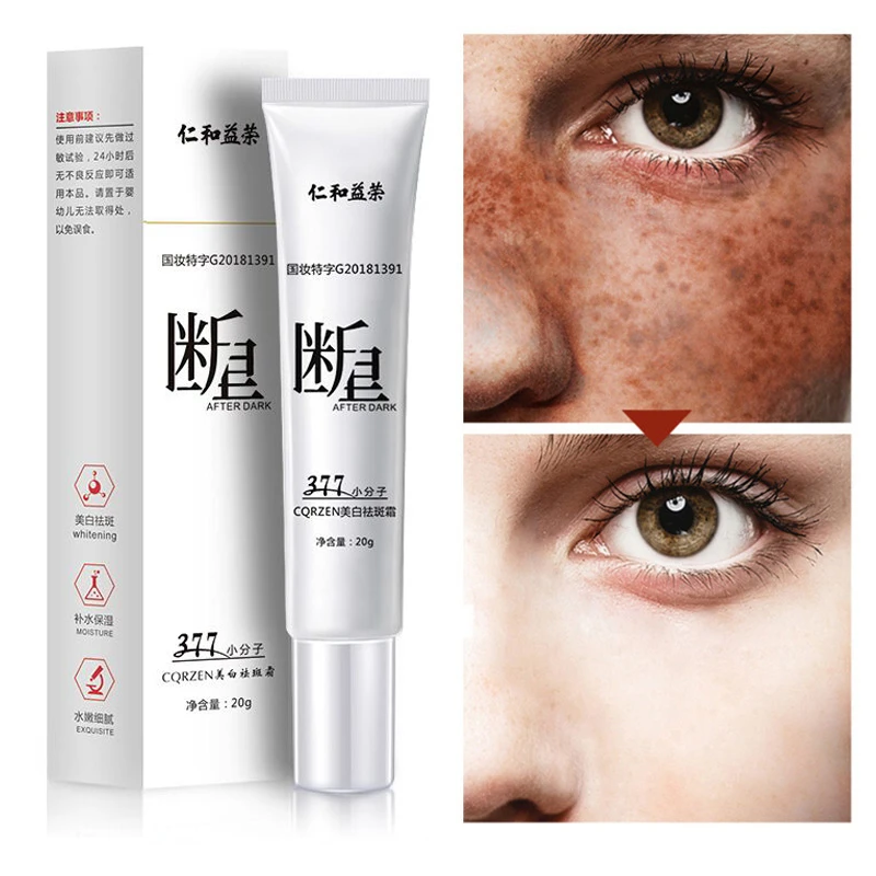 Powerful Whitening Freckle Cream Remove Melasma Acne Spot Pigment Melanin Dark Spots Pigmentation Moisturizing Gel Skin Care