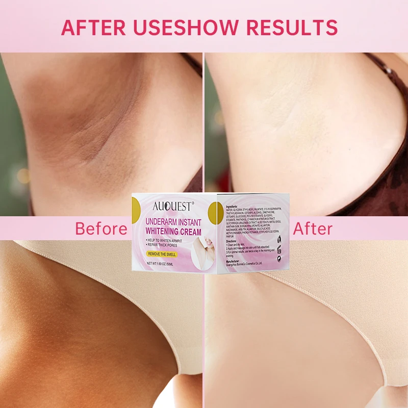 AUQUEST Body Whitening Cream Underarm Armpit Knee Dark Spot Cream Skin Brighten Moisturizing Body Care Cosmetics for Women Men