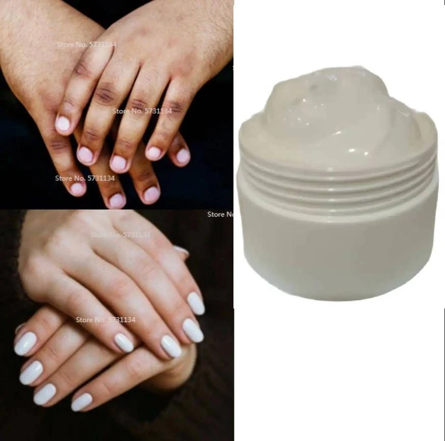 Dark Knuckles Remover Eraser, Clear Knuckles Cream for Hands Fingers Feet